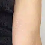 braccio con tatuaggio bianco