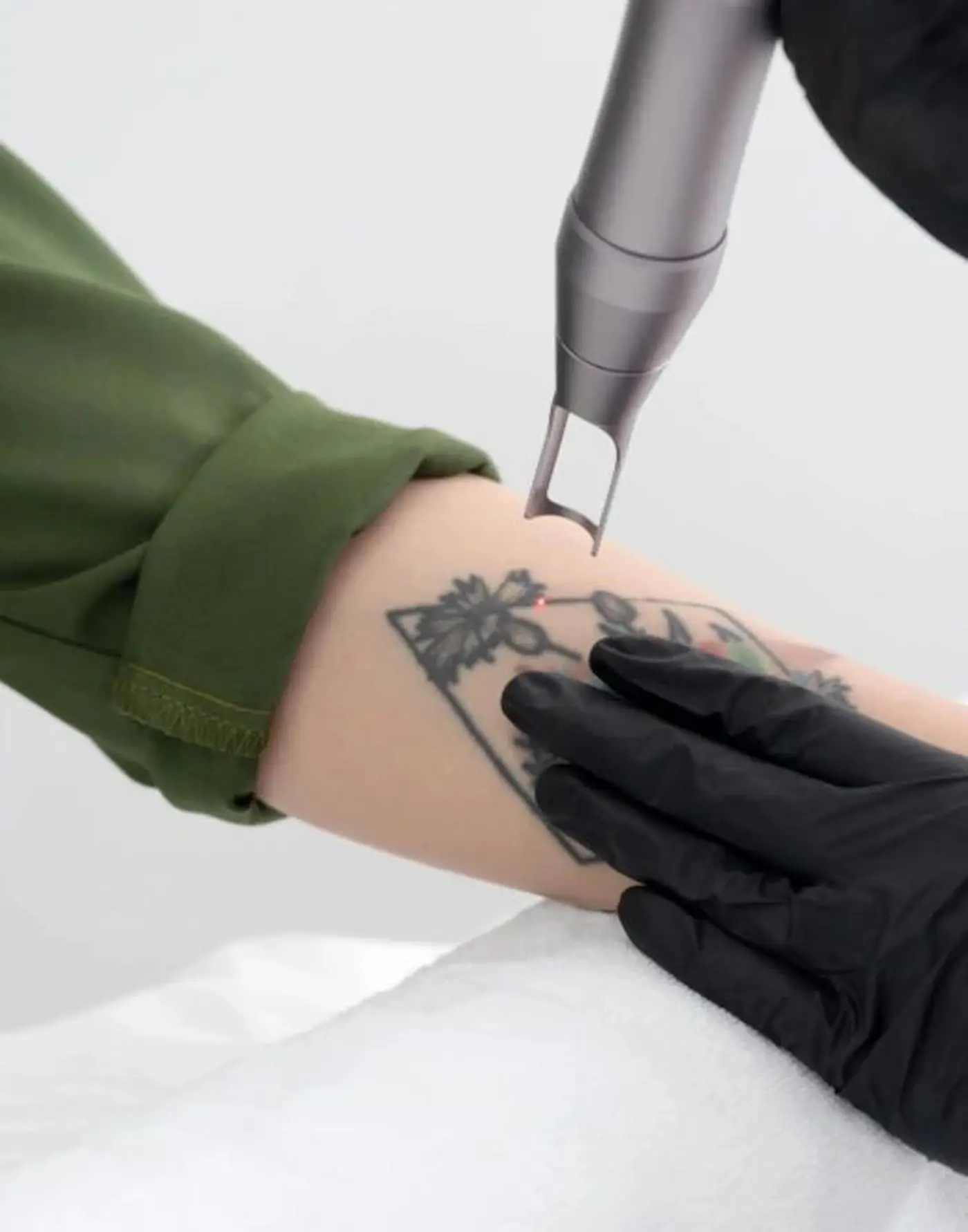 rimozione tatuaggio con laser