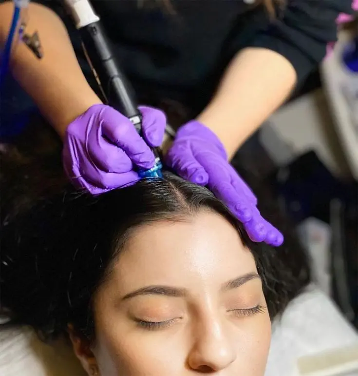 trattamento prp ai capelli
