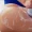 emtone glutei cellulite aurial