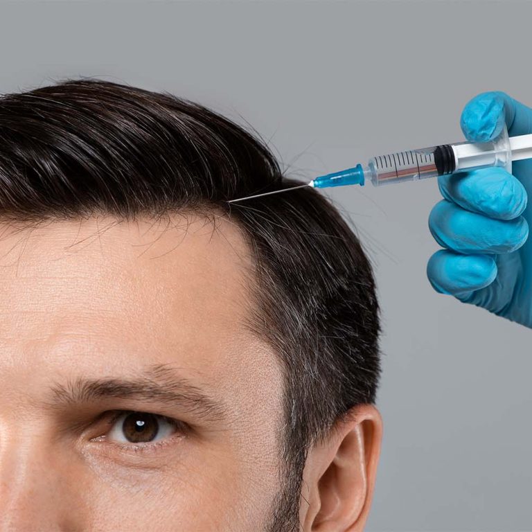 Terapie-tricologiche