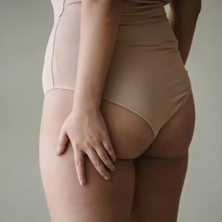 gambe di donna con cellulite