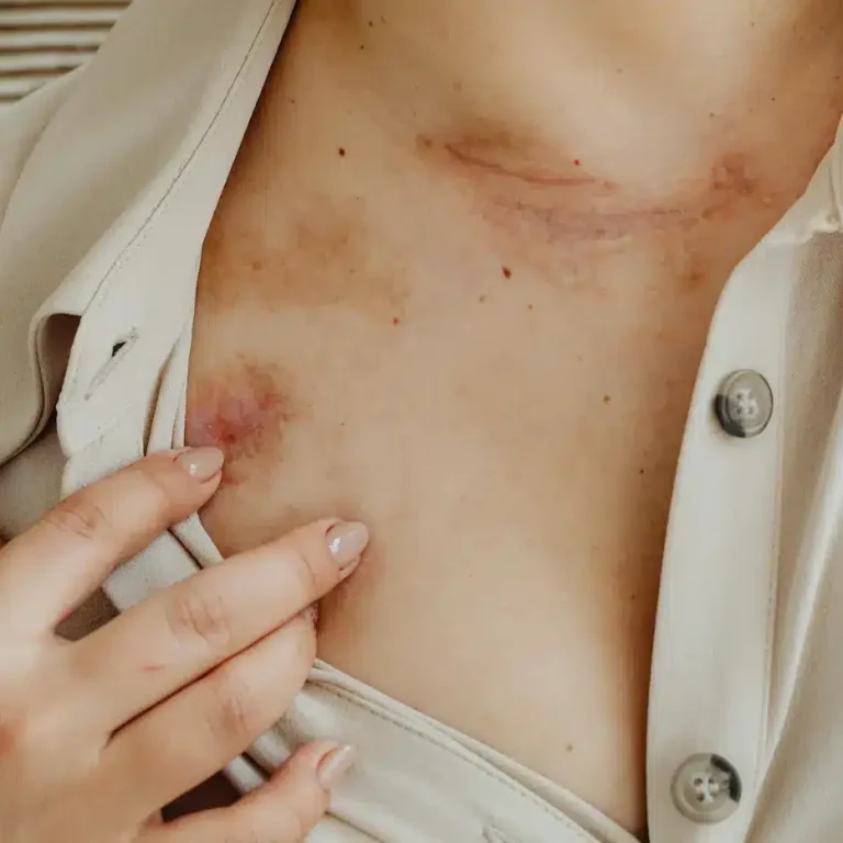 cicatrice sul collo di una donna