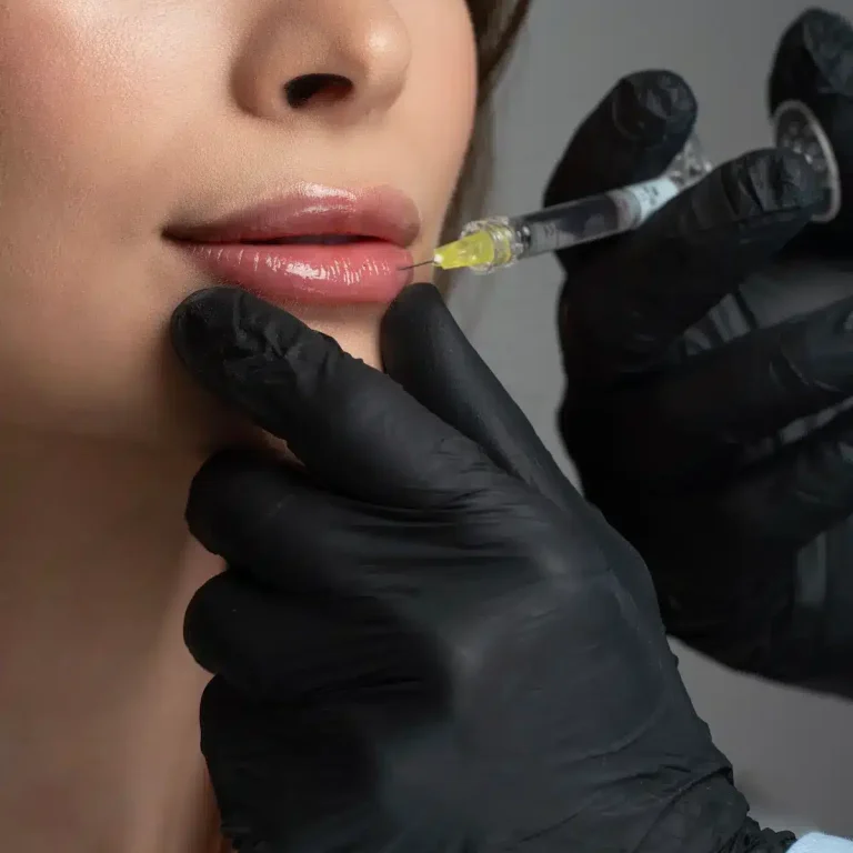 filler labbra