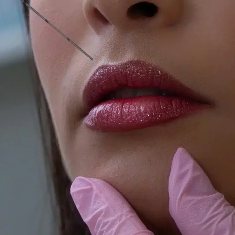 iniezione labbra di botox