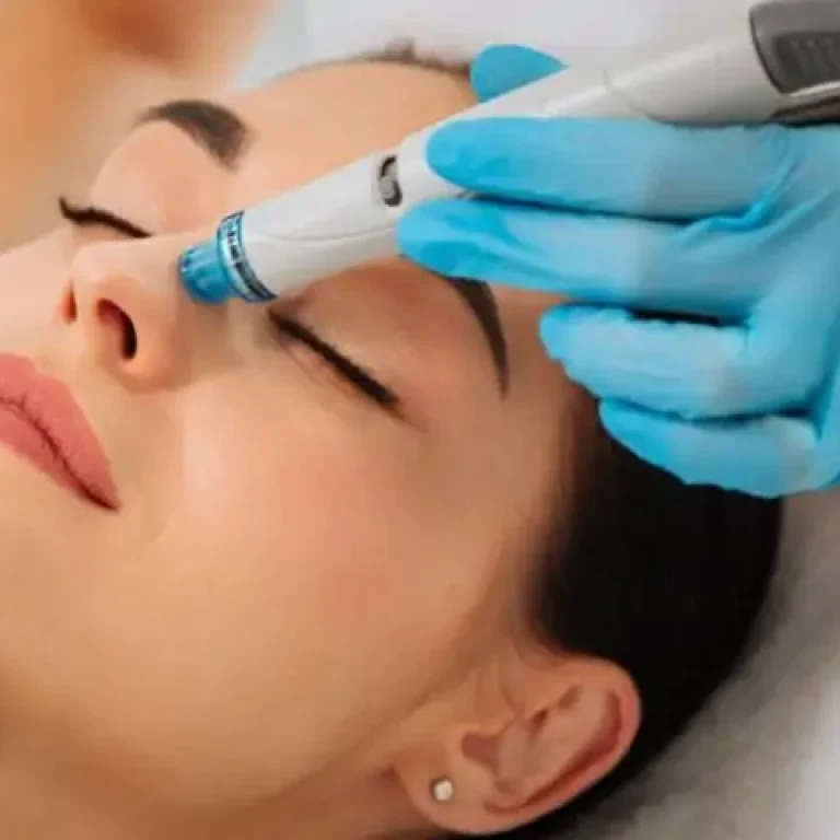 hydrafacial aurial
