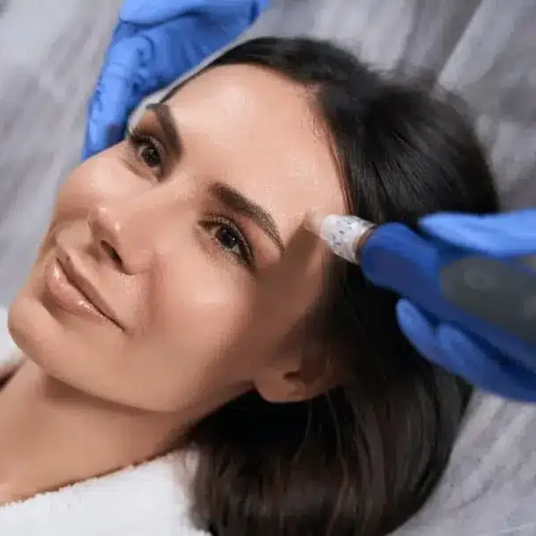 donna che esegue trattamento microneedling con skinpen