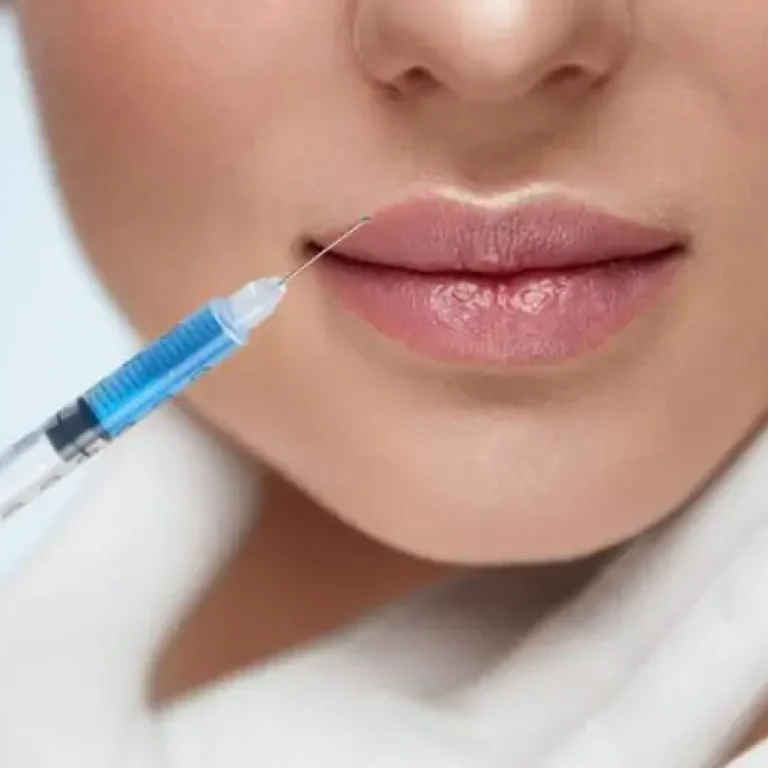 Lipfiller Aurial