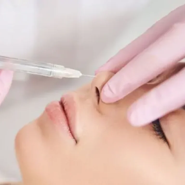 Iniezione per rinofiller a una donna